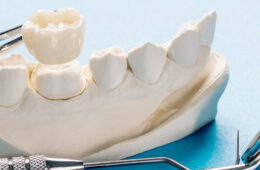 What Is a Dental Crown? Everything You Need to Know