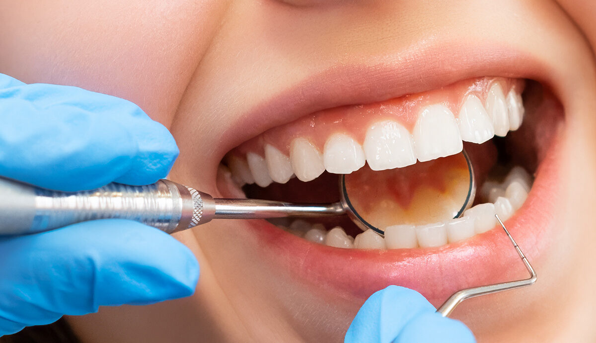 How Often Gum Disease Patients Should Visit the Dentist